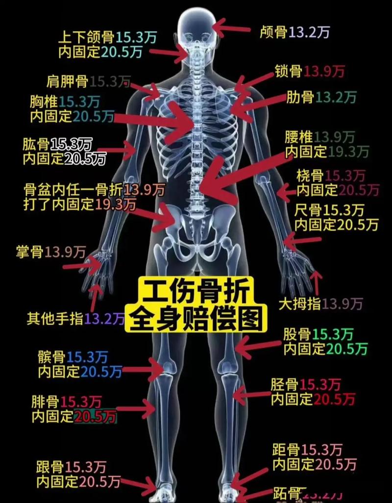 哪些骨折算十级伤残：鉴定标准与实务解析