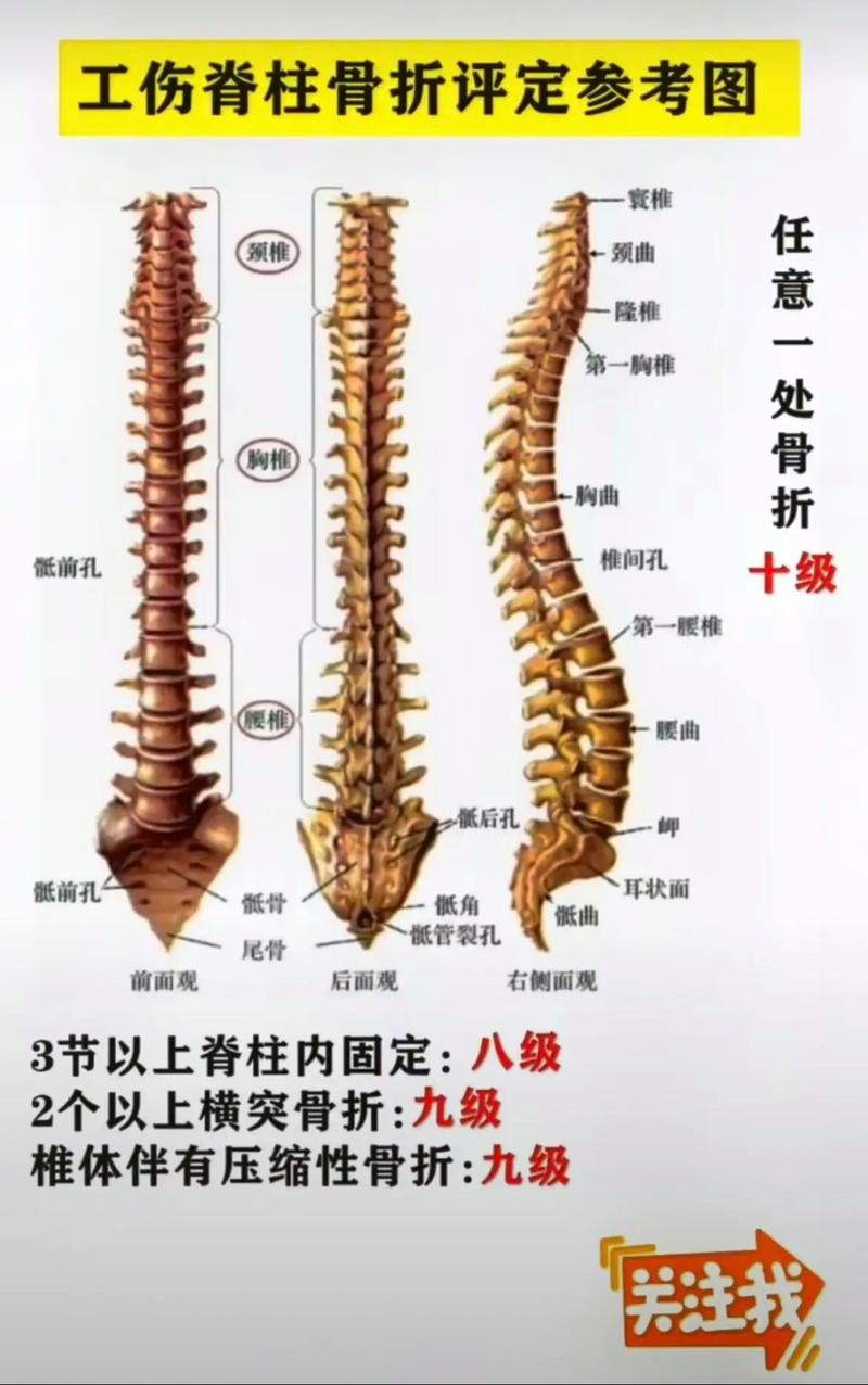 1-10级工伤标准解析：伤残等级与赔偿全攻略