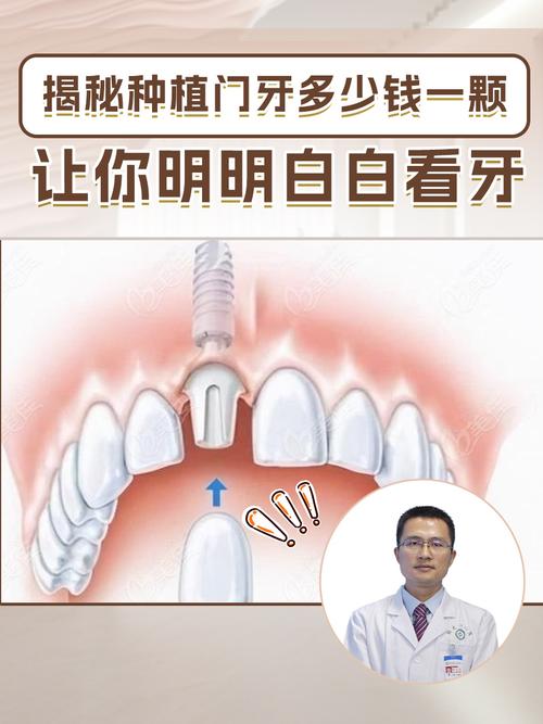 门牙损伤赔偿标准：计算方法与维权指南