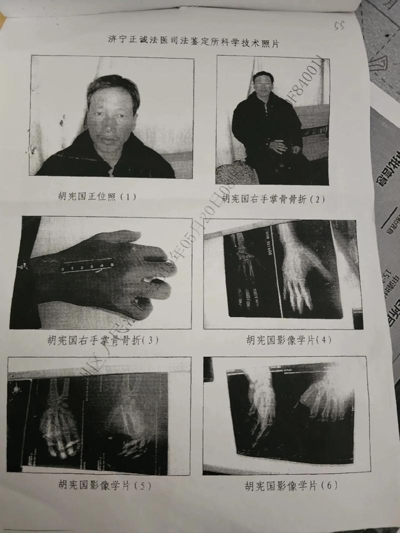交通事故伤残鉴定时机与条件详解