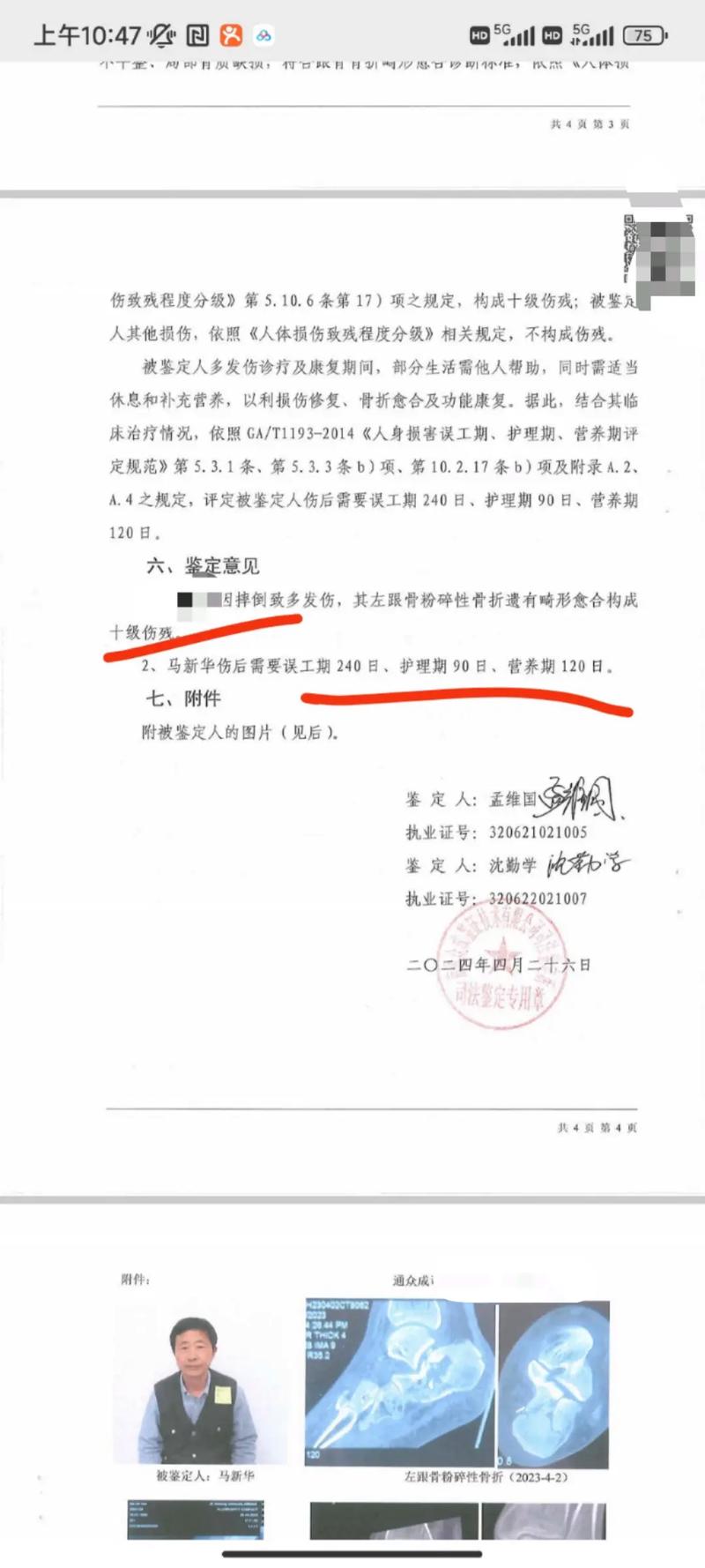 守护幼苗：六岁以下儿童伤残鉴定权威指南