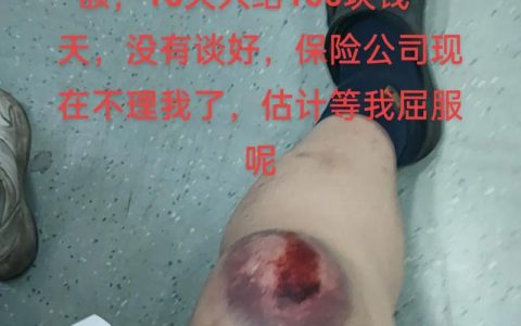 骑手撞人全责赔偿详解：金额构成与影响因素分析
