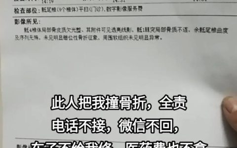 交通事故骨折赔偿全解：对方全责赔偿指南