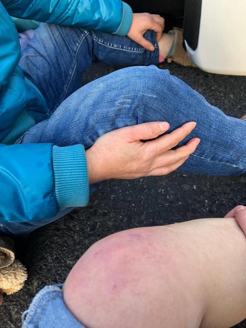 电动车被撞受伤索赔完全指南