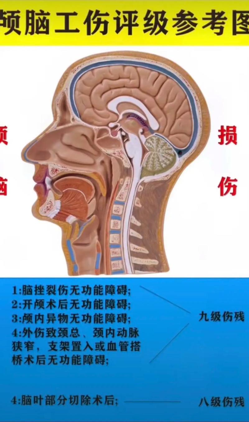 工伤死亡赔偿标准全解：维权必知