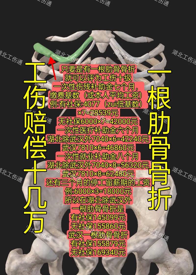 工伤骨折赔偿标准全解析