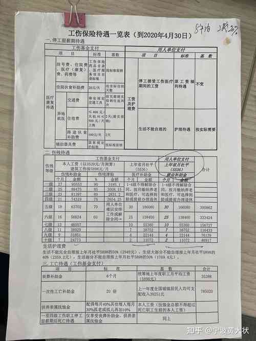 精神损害赔偿要多少钱？权威解读影响因素与标准
