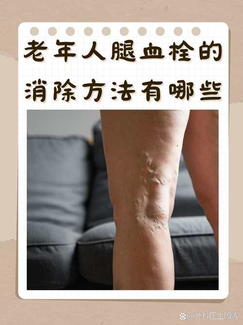 腿伤后血栓困扰？伤残评定十级维权要点