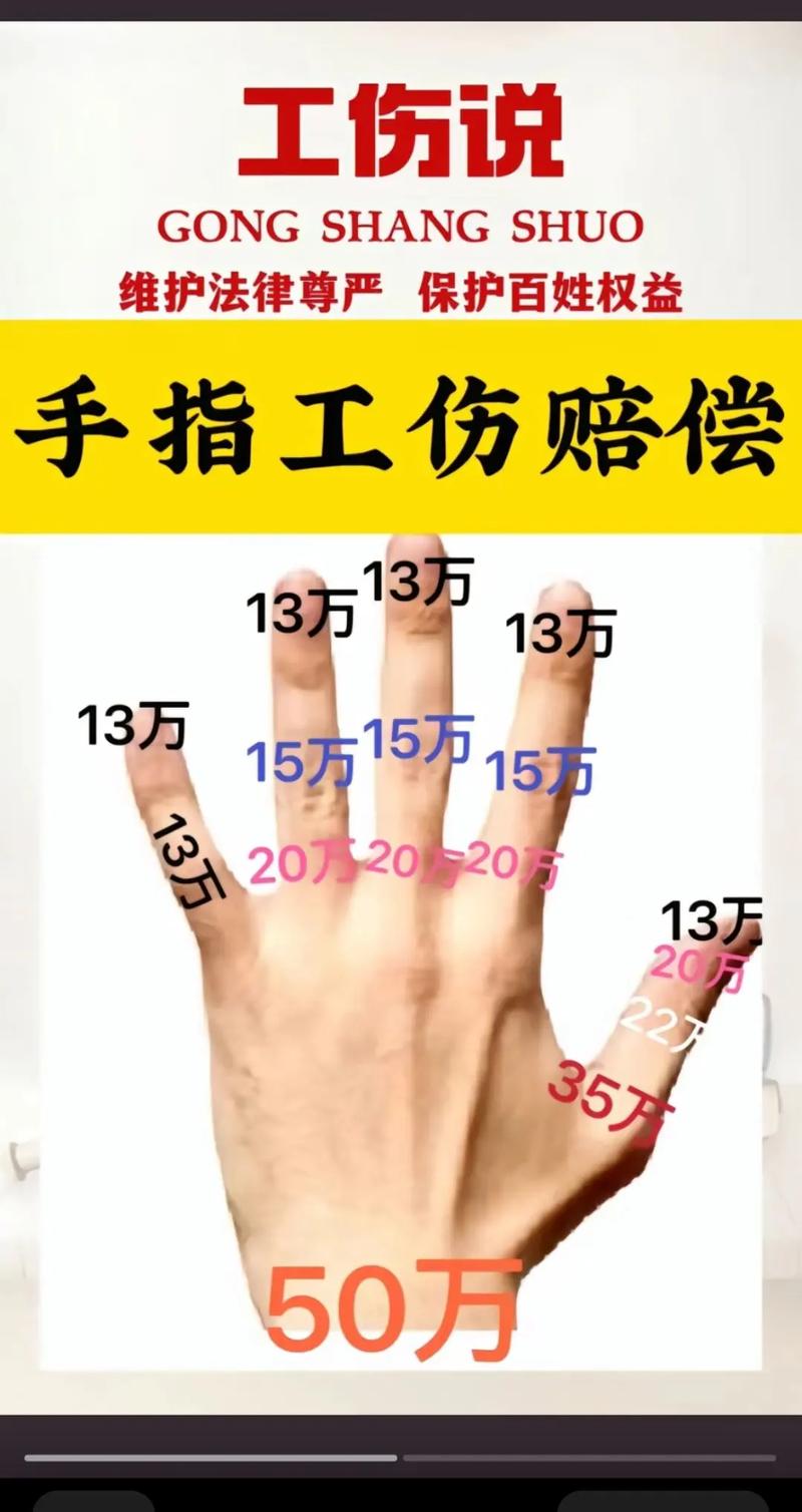 手指工伤怎么办？赔偿标准与维权流程详解