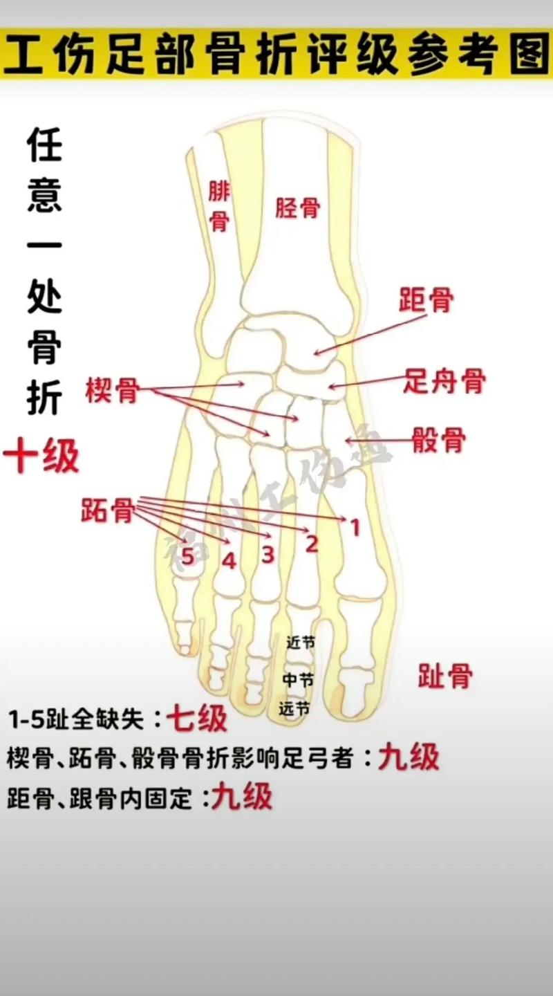 工伤十级赔偿标准详解与维权实操指南