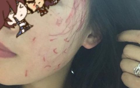 伤人致轻微伤不判刑？行政处罚与赔偿责任详解