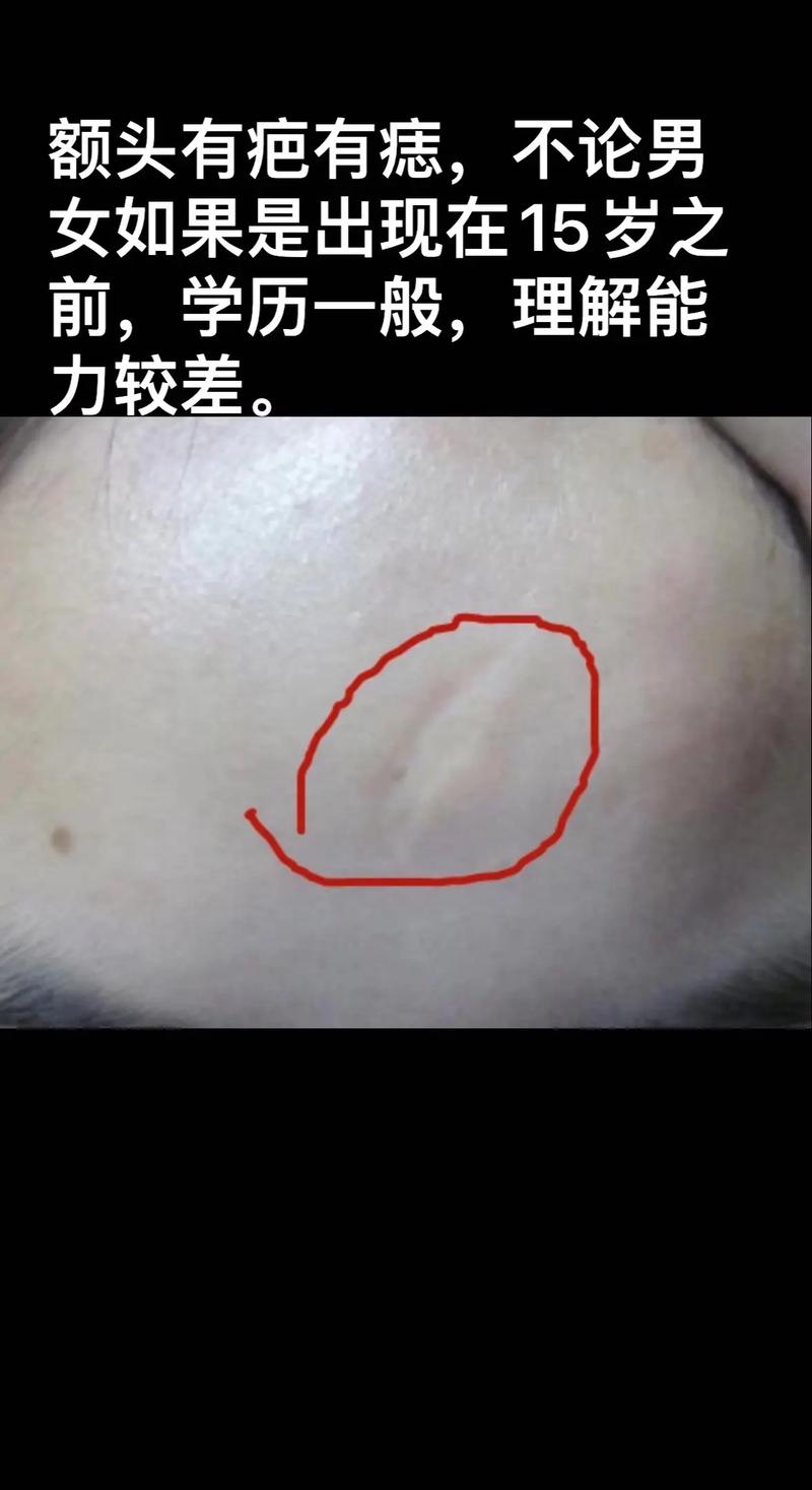 额头疤痕三厘米算不算伤残？权威解读与指引