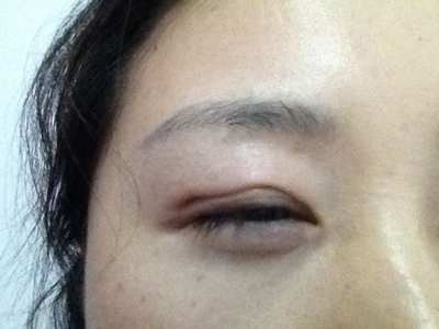 故意弄瞎他人双眼？法律的严惩不容小觑