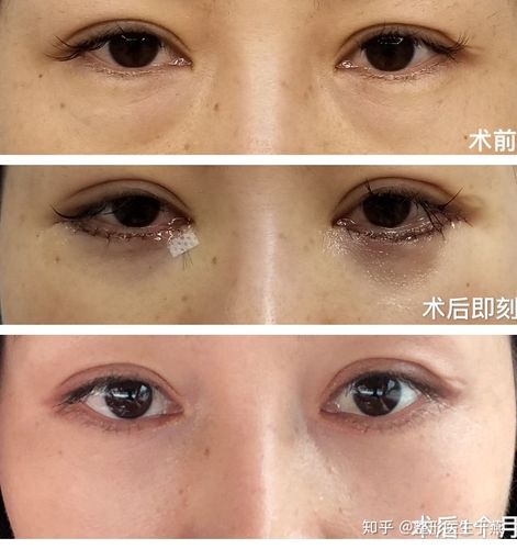 二次酒驾驾照吊销多久可恢复