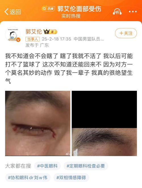 眼睛被打瞎了怎么办？刑责与赔偿权威解读