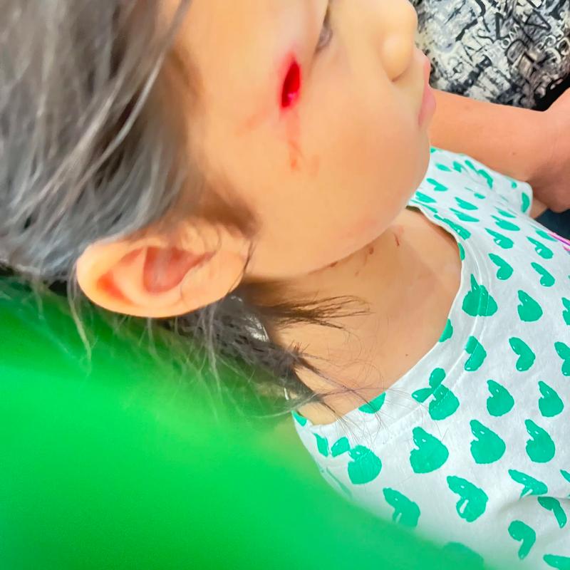 眼睛被打瞎算重伤吗？法律详解