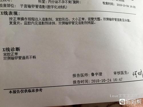 起诉离婚费用大概需要多少钱