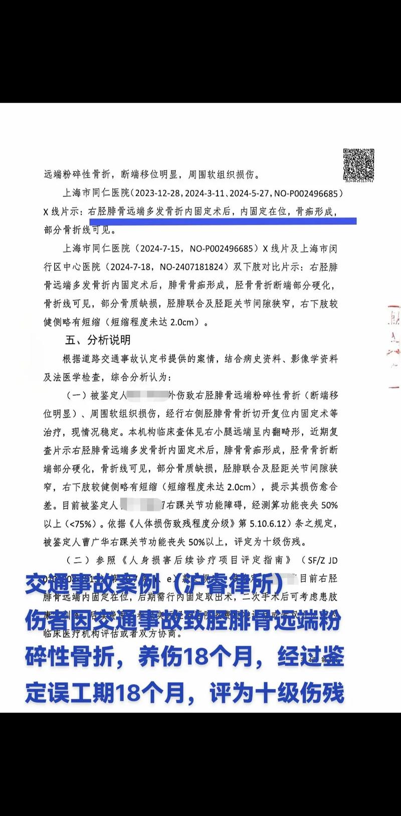 什么样的骨折无法评定为残疾？