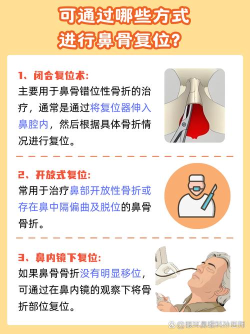 鼻骨骨折不只是小伤，如何依法索赔？