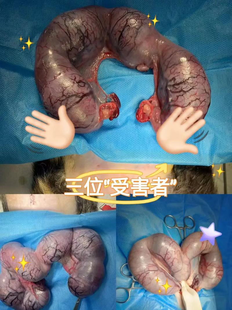 怀孕34周能否引产：法律与医疗解析