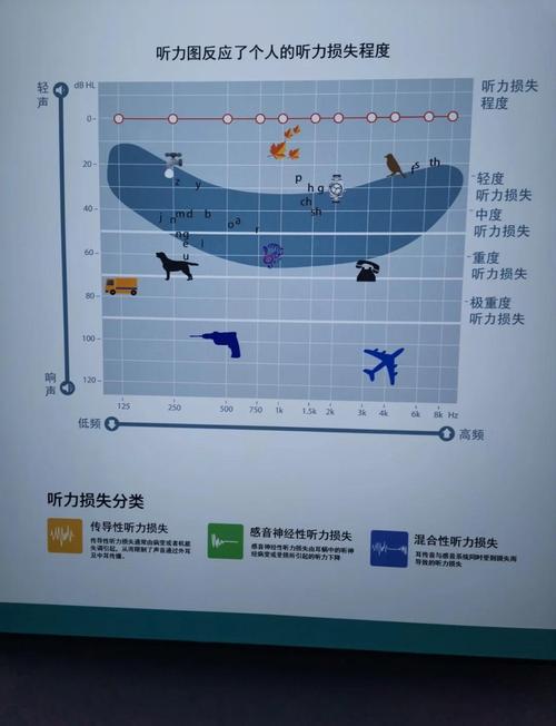 单耳听力损失是否属于残疾解析
